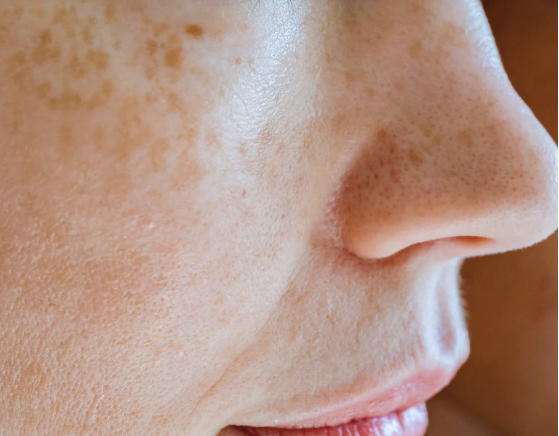 side of woman's face